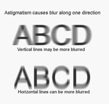 How an astigmatism looks.